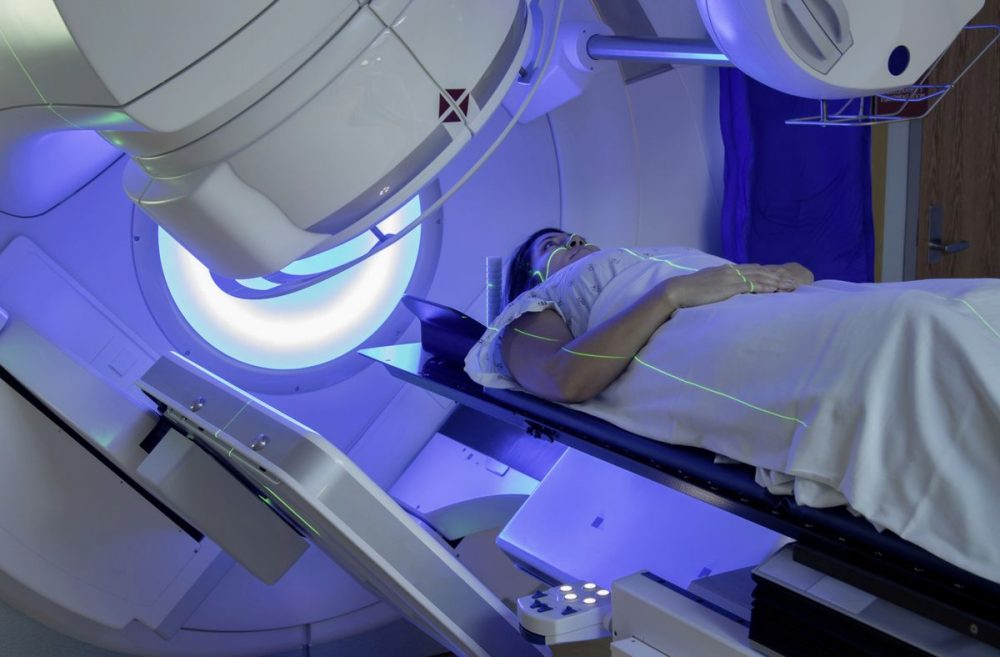 Ce trebuie sa stii despre Radioterapie